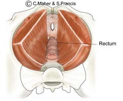 Diagram of a female pelvis indicating the rectum