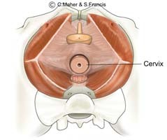 Diagram of a female pelvis indicating the cervix
